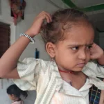 चिरायु योजना बनी बच्चों के लिए जीवनदायिनी, जन्मजात विकृतियों से पीड़ित तीन बच्चों का हुआ निःशुल्क सफल उपचार