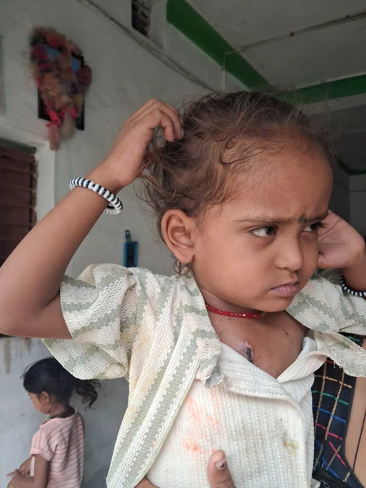 चिरायु योजना बनी बच्चों के लिए जीवनदायिनी, जन्मजात विकृतियों से पीड़ित तीन बच्चों का हुआ निःशुल्क सफल उपचार
